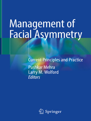 cover image of Management of Facial Asymmetry